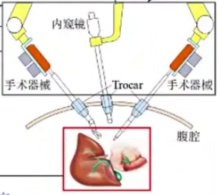 腹腔鏡手術機器人結構設計原理—AIP艾普 腹腔鏡手術機器人結構設計原理—AIP艾普